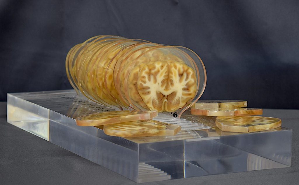 Cortes de encéfalo bovino conservados mediante plastinación con poliéster P40.