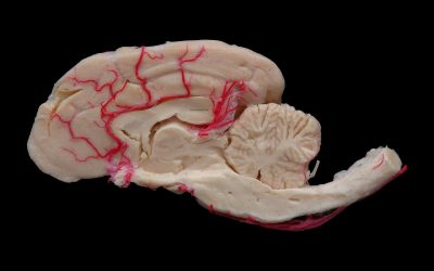 How plastination has revolutionized anatomy education around the world