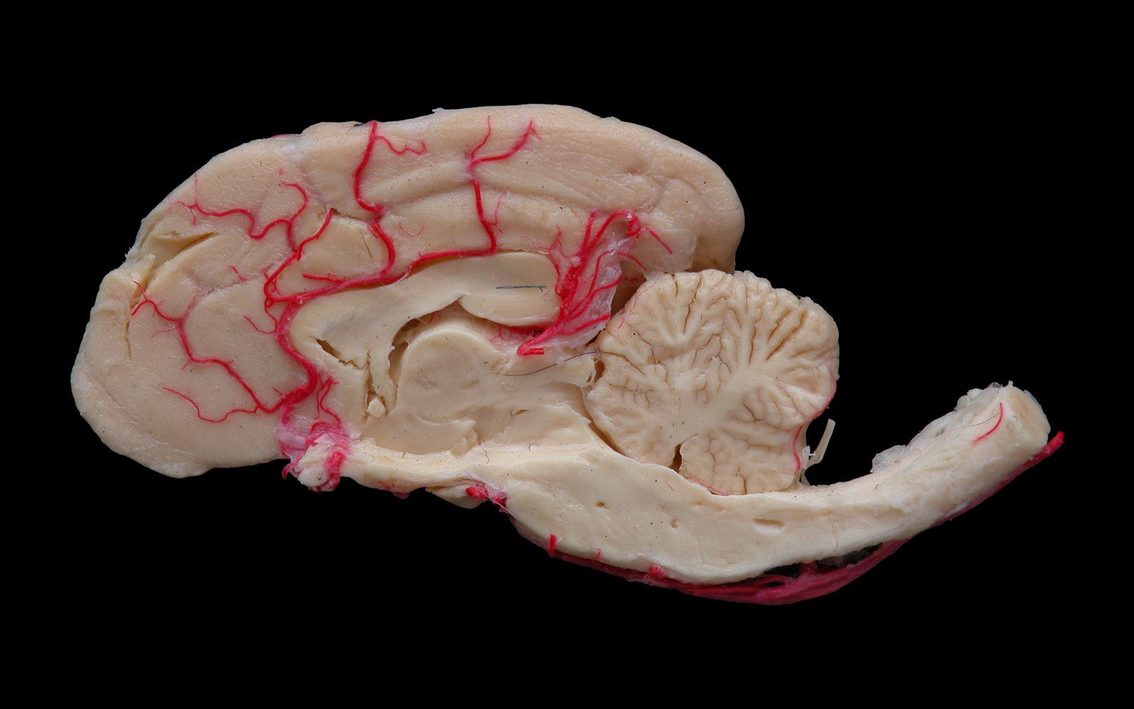 Cómo la plastinación ha revolucionado la enseñanza de la anatomía en todo el mundo