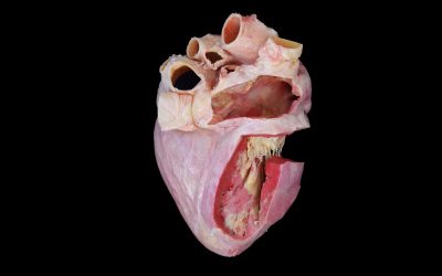 Plastination techniques: from three-dimensional specimens to transparent anatomical slices