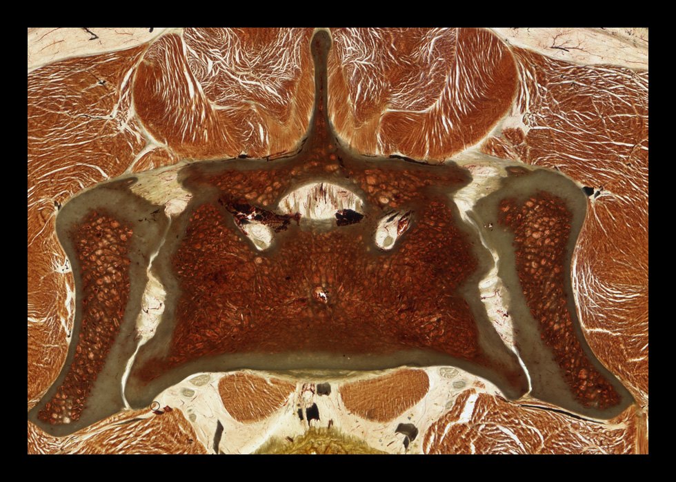 E12 epoxy-plastinated section of the canine sacroiliac region.