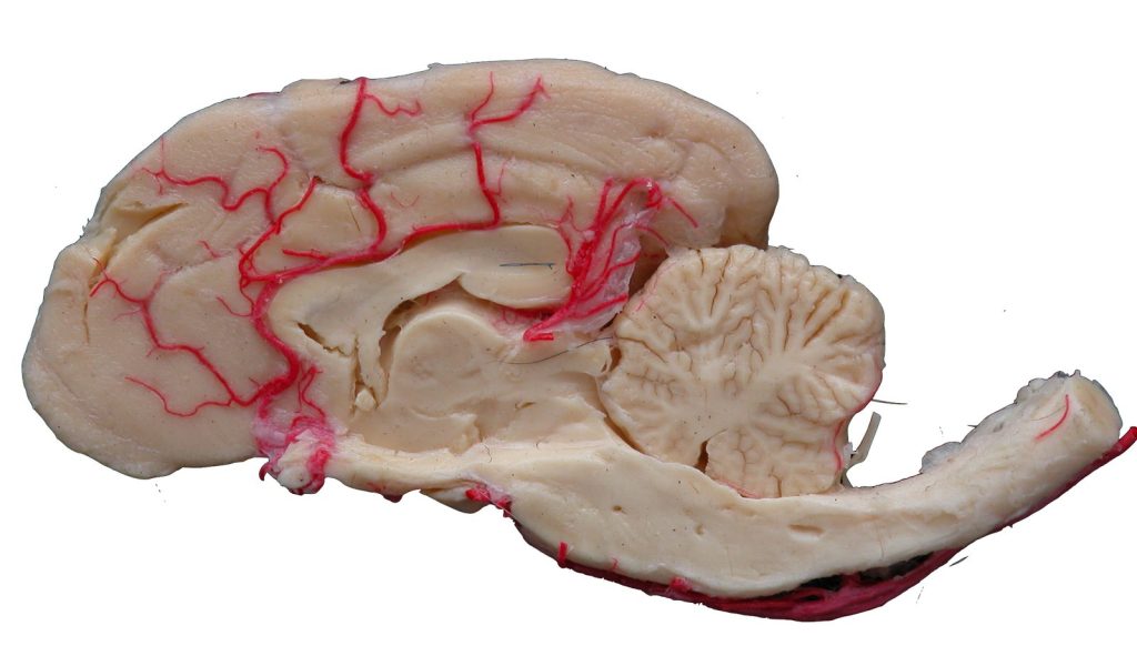 Medial view of a canine half-brain preserved by S10 silicone plastination.