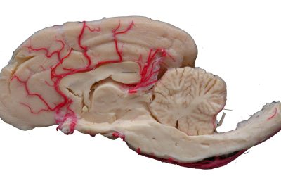 How plastination has revolutionized anatomy education around the world