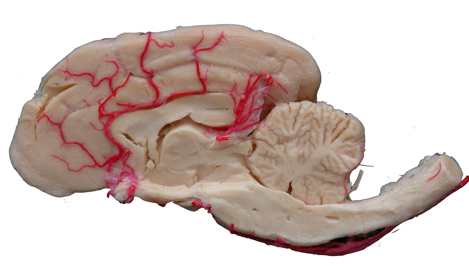 Cómo la plastinación ha revolucionado la enseñanza de la anatomía en todo el mundo
