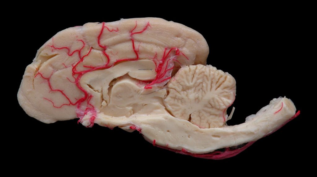 Vista medial de un hemiencéfalo canino conservado mediante plastinación con silicona S10.