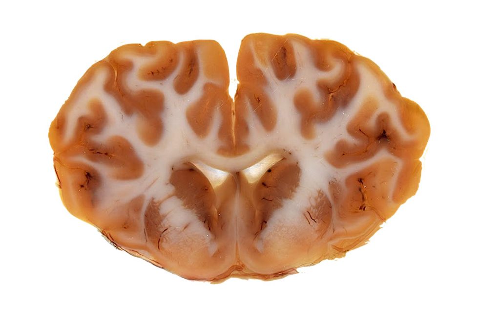P40-plastinated bovine brain section as an anatomical reference for imaging correlation.
