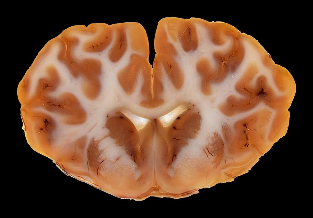 P40-plastinated bovine brain section as an anatomical reference for imaging correlation.