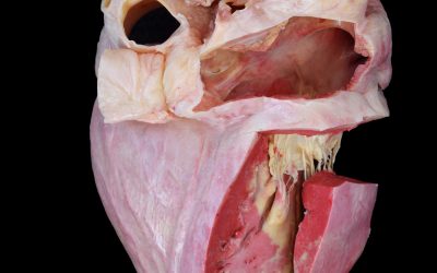 Plastination techniques: from three-dimensional specimens to transparent anatomical slices