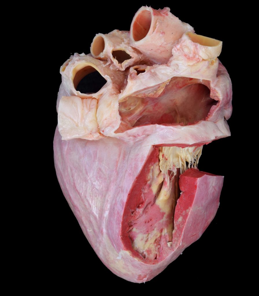 Corazón de cerdo conservado mediante plastinación con silicona, con sus cavidades internas expuestas.