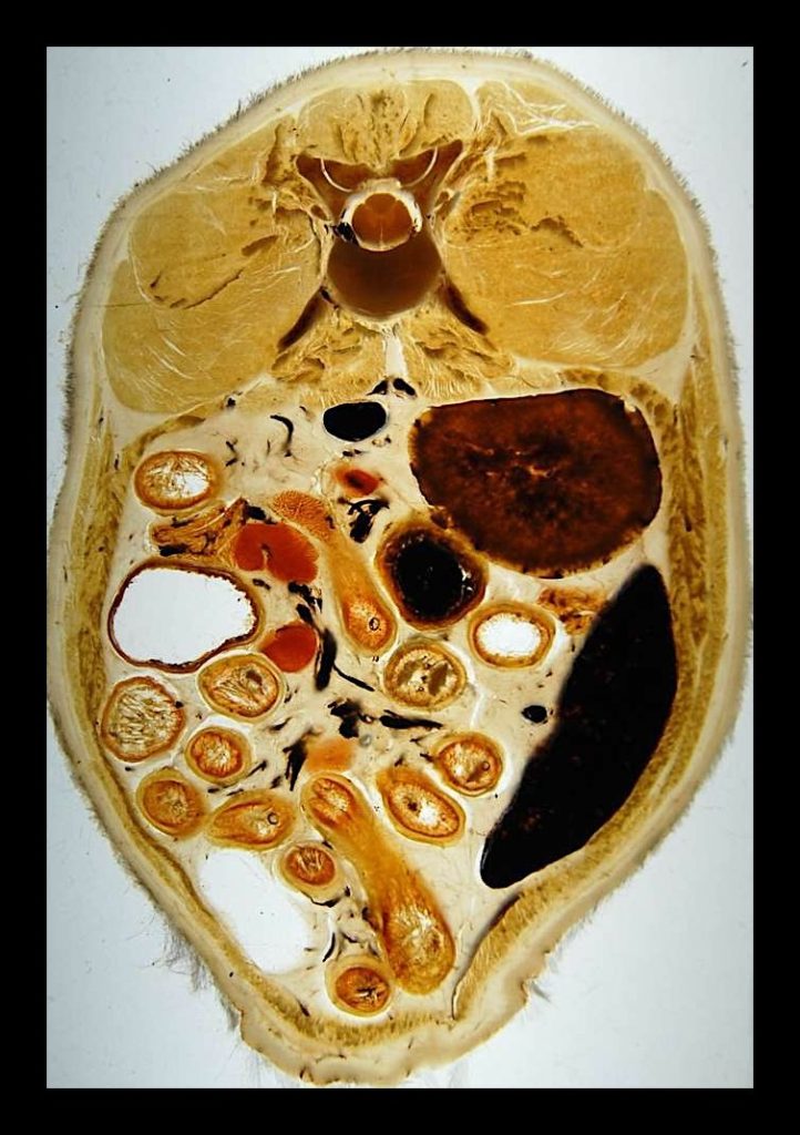 Sección corporal plastinada para estudiar la anatomía topográfica y su relación con las imágenes diagnósticas.
