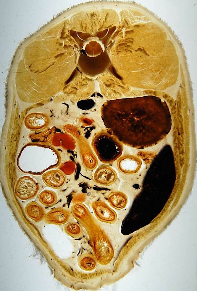 Plastinated body section for studying topographic anatomy and its relationship with diagnostic images.